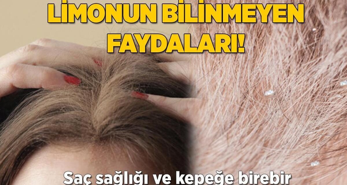 Limonun bilinmeyen faydaları! Saç sağlığı ve kepeğe birebir